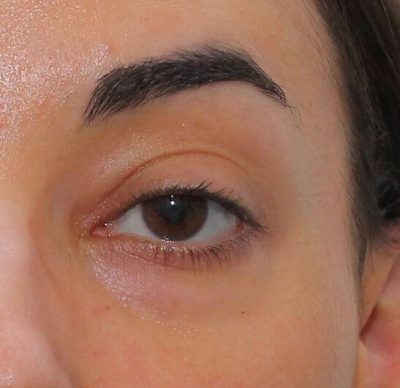 Instituto Visual Dr. David Méndez - 09