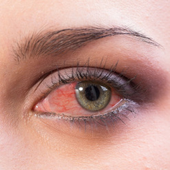 Instituto Visual Dr. David Méndez - 09