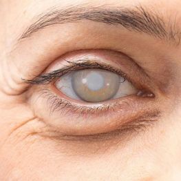 Instituto Visual Dr. David Méndez - 07