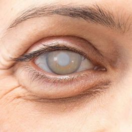 Instituto Visual Dr. David Méndez - 011