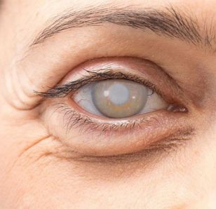 Instituto Visual Dr. David Méndez - 05