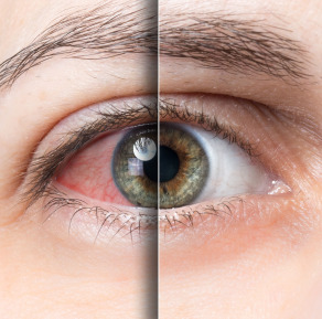 Instituto Visual Dr. David Méndez - 07