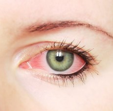 Instituto Visual Dr. David Méndez - 07