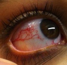 Instituto Visual Dr. David Méndez - 011